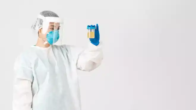 10 Warna Urine yang Sehat dan Abnormal, Cek Bedanya!