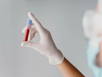 5 Persiapan Sebelum Donor Darah, Wajib Diperhatikan!