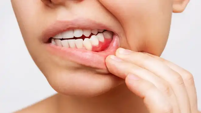 Does Bleeding Break Fast? Check Out the Explanation!
